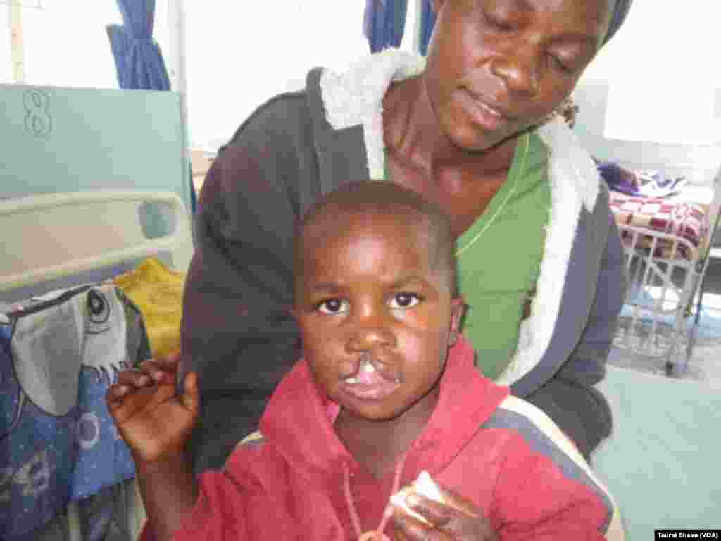 Mother of 2-Year-Old Kudakwashe Hove Is Happy Her Toddler Is Finally Getting Corrective Surgery