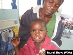 Mother of two-year-old Kudakwashe Hove is Happy her toddler is finally getting corrective surgery.