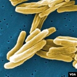 Contoh gambar bakteri mikro tuberkulosis. Sekarang dikhawatirkan bahwa jenis yang berkembang di Eropa saat ini, adalah varian yang kebal antibiotik.