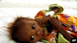 Malnourished Indian child Nitesh rests on his bed at the Kalyani Nutrition Rehabilitation Centre (NRC) in Shivpuri district some 113 kms from Gwalior (File Photo)