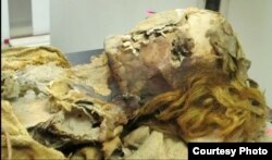 This mummy of an Egyptian woman who was between 45 and 50 years old when she died, is from an unknown era and shows evidence of heart disease. (The Lancet)
