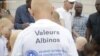 Malawi: les autorités distribuent des gadgets de sécurité aux albininos