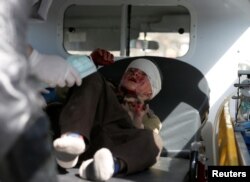 An injured boy is seen in an ambulance after a blast in Kabul, Afghanistan, Jan. 27, 2018.