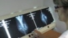New Breast Cancer Treatment Shows Great Promise
