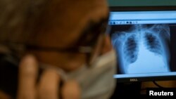 Seorang dokter menelpon kerabat pasien untuk mengabarkan kondisi medis pasien berdasarkan hasil foto rontgen di Max Smart, rumah sakit khusus perawatan pasien Covid-19 di New Delhi, India, 5 September 2020. (REUTERS / Danish Sid).