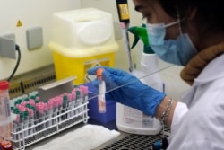 Seminar Kibir, a health lab technician, processes analysis of some nasal swab samples to test for COVID-19 at the Hospital of Argenteuil, north of Paris, Sept. 25, 2020.