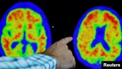 FILE - A doctor points out evidence of Alzheimer's disease on PET scans at the Center for Alzheimer Research and Treatment (CART) at Brigham And Women's Hospital in Boston, Massachusetts, U.S., March 30, 2023. (REUTERS/Brian Snyder)