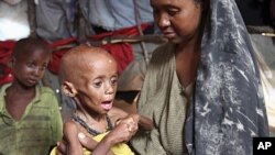 An internally displaced Somali woman holds her malnourished child inside their temporary home in Hodan district, south of Somalia's capital Mogadishu, September 20, 2011.