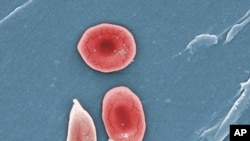 FILE - This 2009 colorized microscope image made available by the Sickle Cell Foundation of Georgia via the Centers for Disease Control and Prevention shows a sickle cell, left, and normal red blood cells of a patient with sickle cell anemia.