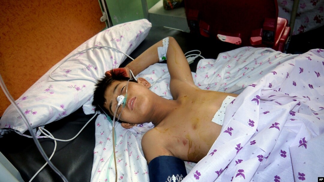 Salah seorang remaja yang terluka dirawat di rumah sakit di Puli Khumri, provinsi Baghlan pasca baku tembak di acara pernikahan Minggu (26/7).