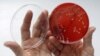 Hallan cómo combatir a bacterias resistentes