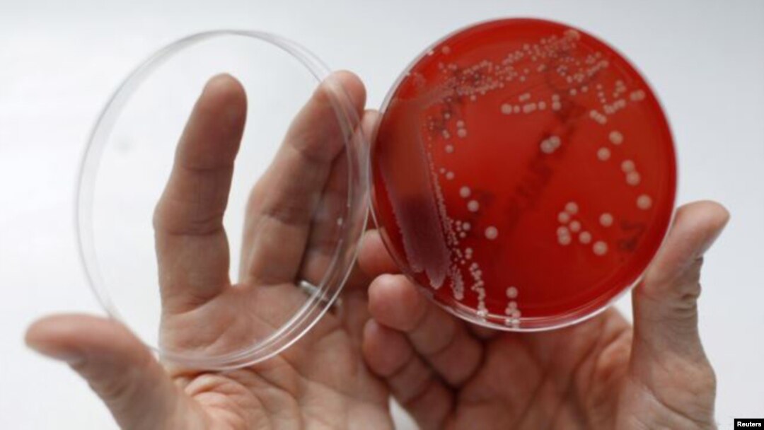 La clave consistiría en aislar a la bacteria de su propia superficie protectora, que opera como una armadura.