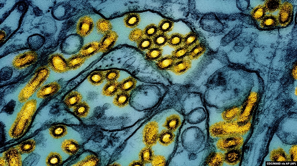 FILE - This colorized electron microscope image released by the National Institute of Allergy and Infectious Diseases on March 26, 2024, shows avian influenza A H5N1 virus particles. (CDC/NIAID via AP, File)