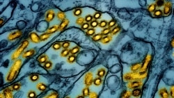 FILE - This colorized electron microscope image released by the National Institute of Allergy and Infectious Diseases on March 26, 2024, shows avian influenza A H5N1 virus particles. (CDC/NIAID via AP, File)