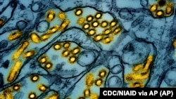 FILE - This colorized electron microscope image released by the National Institute of Allergy and Infectious Diseases on March 26, 2024, shows avian influenza A H5N1 virus particles. (CDC/NIAID via AP, File)