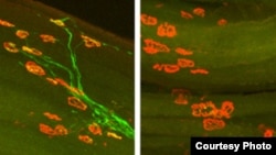 Images of axon regeneration in mice two weeks after injury to the hind leg’s sciatic nerve. On the left, axons (green) of a normal mouse have regrown to their targets (red) in the muscle. On the right, a mouse lacking DLK shows no axons have regenerated, 