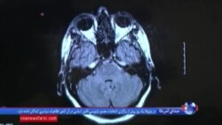 تحقیقات جدید در مورد ضربه به مغز