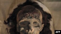 Tutankamon umro od malarije