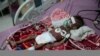 UN Warns COVID-19 is ‘Roaring Back' as Yemen Faces Famine