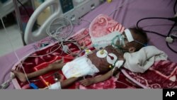 FILE - In this Nov. 3, 2020, photo, a malnourished girl receives treatment at a feeding center at Al-Sabeen hospital in Sanaa, Yemen. 