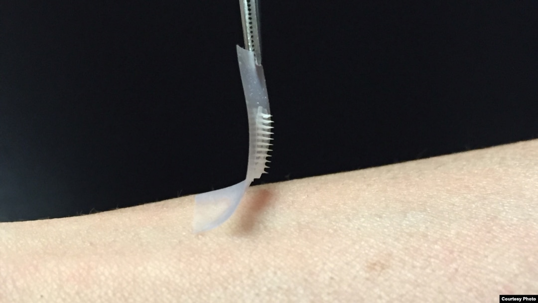 "Plester insulin pintar" dikembangkan oleh para peneliti di Departemen Rekayasa Biomedis UNC/NC gabungan. (Foto: laboratorium Zhen Gu, Ph.D.)