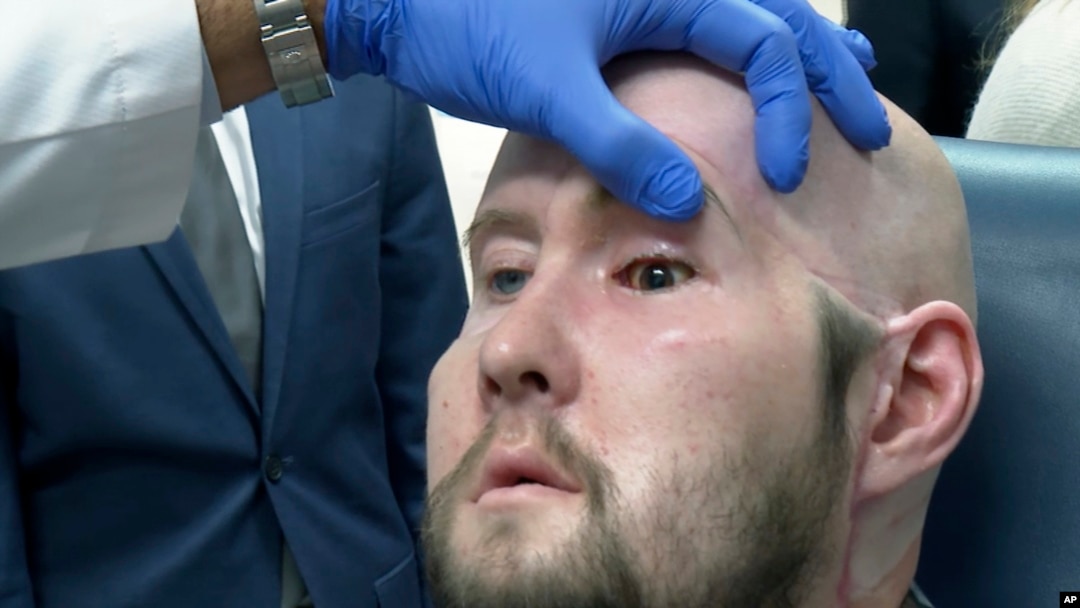Doktor Eduardo Rodrigez, plastični hirurg pregleda oko Arona Džejmsa (Foto: AP/Joseph. B. Frederick)