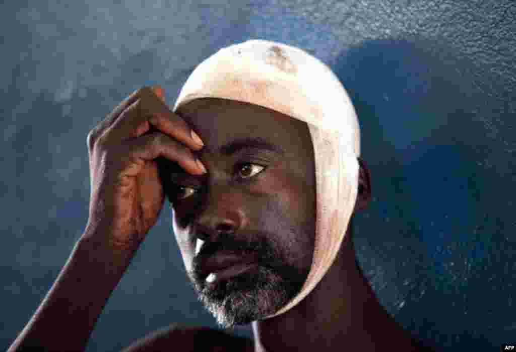 April 20: A victim of post-election violence waits for treatment at St. Gerard's Hospital in Kaduna, Nigeria. (AP Photo/Sunday Alamba)