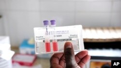 FILE—A laboratory technician examines sickle cell blood samples, at the Mbale Regional Referral Hospital in Mbale, Uganda, Wednesday, April 24, 2024.