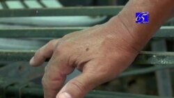 Զիկա հիվանդության տարածման հավանականությունը մեծ է ԱՄՆ-ում