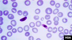 Parasit Plasmodium Falciparum, protozoa satu sel yang hidup dalam nyamuk dan menyebabkan tipe malaria yang paling mematikan, tampak di antara sel-sel darah.