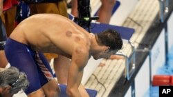 Tanda-tanda bulatan bekas bekam di tubuh perenang Michael Phelps membuat banyak orang bertanya-tanya (7/8).