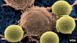 La modificación genética de linfocitos “T” permitió destruir células sanguíneas cancerosas.