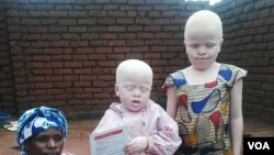 Umama labantwabakhe abazalwa beleAlbinism oweMalawi