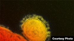 A colorized image of the MERS coronavirus as seen through an electron micrograph.