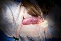 A genetically engineered pig kidney appears healthy during a transplant operation at NYU Langone in New York, U.S., in this undated handout photo.