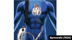 Total Artificial Heart, ilustracija