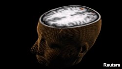 An undated image of the human brain taken through scanning technology. The scan shows a person responding to a visual scene, with the imaging technology measuring increases in blood flow to a certain region of the brain. 