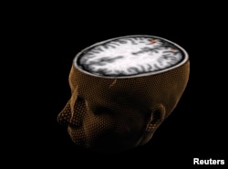 An undated image of the human brain taken through scanning technology. The scan shows a person responding to a visual scene, with the imaging technology measuring increases in blood flow to a certain region of the brain.