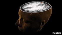 The human brain is seen with scanning technology. (Reuters)