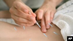 Acupuncture needles in the muscles around the spine of a patient to relieve lower back pain.