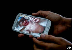 A doctor shows on her mobile phone a photo of Fadl, an 8-month-old Yemeni boy taken in his last days before he starved to death, in this Feb. 10, 2018 photo at a hospital in Mocha, Yemen.