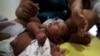 Can Scientists Prove Zika Virus Causing Birth Defects?