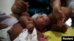 Gustavo Henrique who is 2-months old and born with microcephaly, reacts to stimulus during an evaluation session with a physiotherapist at the Altino Ventura rehabilitation center in Recife, Brazil, Feb. 11, 2016. 