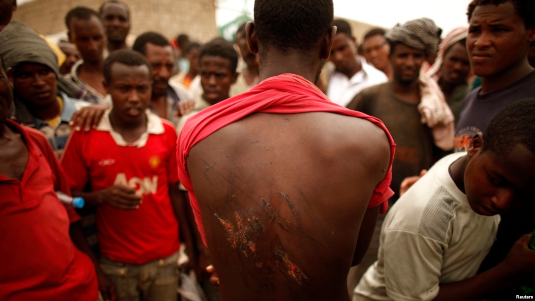Bakon haure daga Ethiopia yake nuna tabban akubar da masu safarar mutane suka gana masa.