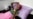Emaciated Yemeni Woman Now Smiles but Recovery Patchy