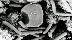 Foto microscópica de la bacteria Bacillus anthracis del ántrax