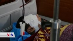 چارەسەرکردنی ژمارەیەک لە بریندارەکانی تەقینەوەکەی حەسەکە لە دهۆک