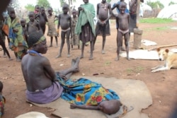 A sick child at Naipuru camp for internally displaced persons in Jebel Boma County. (John Tanza/VOA)