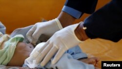 FILE - A nurse checks a boy at a cholera treatment center at the al-Sabeen hospital in Sanaa, Yemen, Oct. 3, 2018. 