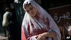 A Sep. 20, 2012 photo shows a wounded woman still in shock leaves Dar El Shifa hospital in Aleppo, Syria. 